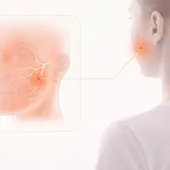 Illustration visar nerver i ansiktet, med en röd markering som indikerar stickningar i ansiktet runt munnen.