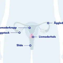Illustration av kvinnans reproduktionsorgan med textetiketter: livmoderkropp, äggstock, äggledare, livmoderhals, slida. Om min tjej har HPV, kan detta vara relevant.
