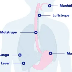 Illustration av matstrupen, lungor, magsäck och lever. Kan visa var en kramp i matstrupen kan kännas.