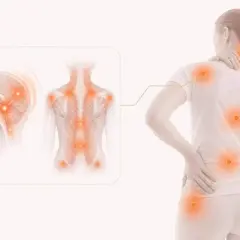 Illustration visar hur smärta kan uppstå i hjärnan och kroppen, vilket kan förklara varför man får myalgi.