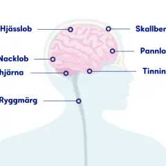 Illustration visar hjärnan och ryggmärgen med markeringar för olika slags huvudvärk: skallben, hjässlob, pannlob, tinninglob, nacklob och lillhjärna.
