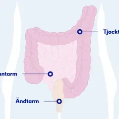 Illustration av tunntarm, tjocktarm och ändtarm. Kan vara relevant om du har ont i magen efter mat.