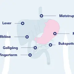 Illustration av matsmältningsorganen: lever, magsäck, bukspottkörtel, gallblåsa, gallgång, tolvfingertarm och matstrupe. Viktigt att upptäcka aggressiv cancer i magen tidigt.
