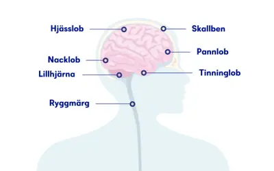 Illustration visar hjärnan och ryggmärgen med markeringar för olika slags huvudvärk: skallben, hjässlob, pannlob, tinninglob, nacklob och lillhjärna.