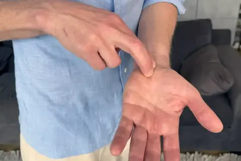 En man pekar på sin handled, kanske för att visa var han känner ont i nacken och domningar i fingrarna.