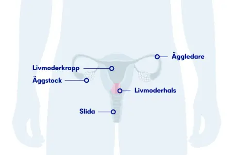 Illustration av kvinnans reproduktionsorgan med textetiketter: livmoderkropp, äggstock, äggledare, livmoderhals, slida. Om min tjej har HPV, kan detta vara relevant.