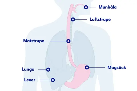 Illustration av matstrupen, lungor, magsäck och lever. Kan visa var en kramp i matstrupen kan kännas.