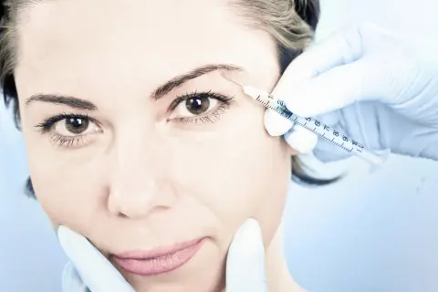 En kvinna får en injektion med botulinumtoxin, även känt som botox, i pannan för att släta ut rynkor.