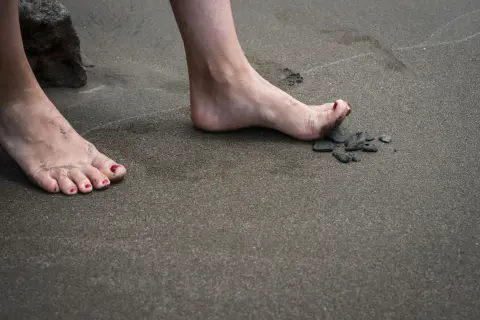 Nära en sten på stranden, en bar fot med rött nagellack och sand mellan tårna. En annan fot med eversion fot syns i bakgrunden.