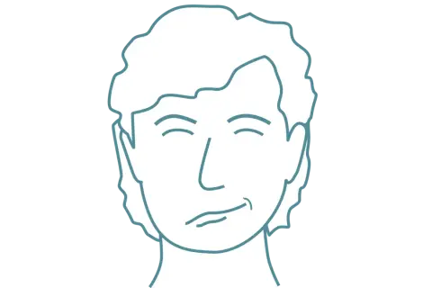 Enkel illustration av ett ansikte med slutna ögon och en snett leende mun, som visar tecken på perifer facialispares.