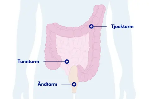 Illustration av tunntarm, tjocktarm och ändtarm. Kan vara relevant om du har ont i magen efter mat.