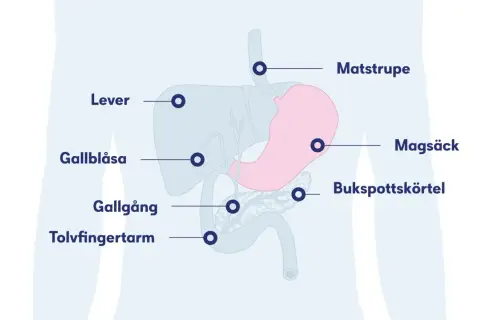 Illustration av matsmältningsorganen: lever, magsäck, bukspottkörtel, gallblåsa, gallgång, tolvfingertarm och matstrupe. Viktigt att upptäcka aggressiv cancer i magen tidigt.