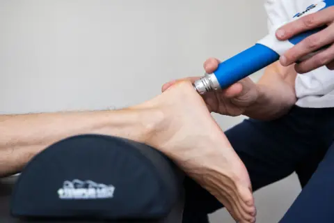Behandling med stötvåg för att lindra smärta vid plantar fasciit. En blå enhet används på hälen.