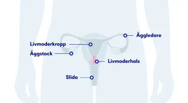 Illustration av kvinnans reproduktionsorgan med textetiketter: livmoderkropp, äggstock, äggledare, livmoderhals, slida. Om min tjej har HPV, kan detta vara relevant.