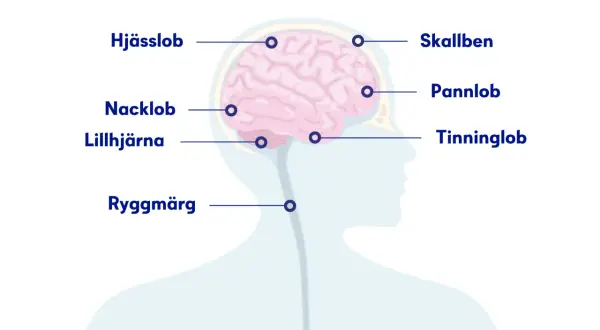 Illustration visar hjärnan och ryggmärgen med markeringar för olika slags huvudvärk: skallben, hjässlob, pannlob, tinninglob, nacklob och lillhjärna.