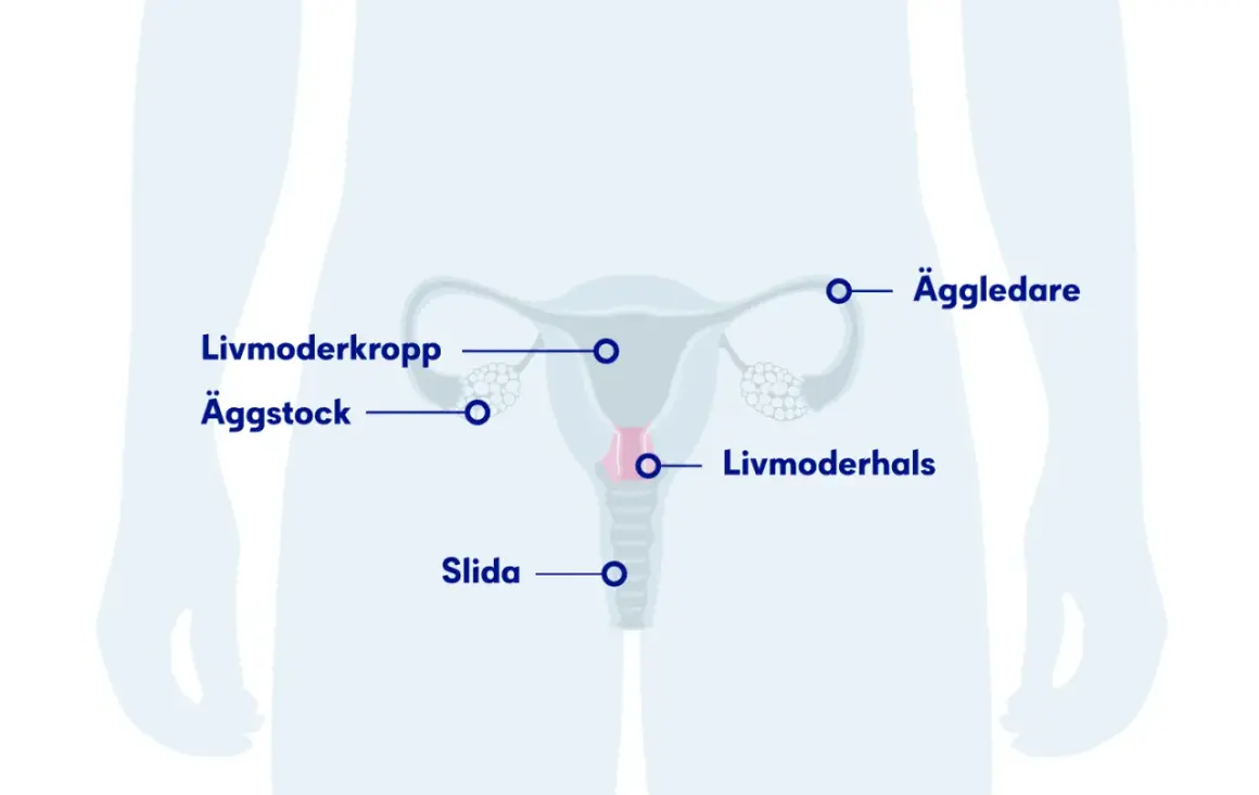 Illustration av kvinnans reproduktionsorgan med textetiketter: livmoderkropp, äggstock, äggledare, livmoderhals, slida. Om min tjej har HPV, kan detta vara relevant.
