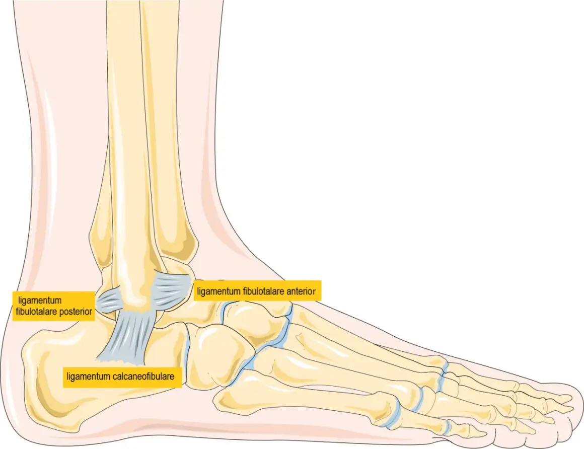 Illustration av fotens ben och ligament. Kan visa ett brutet ben i foten.