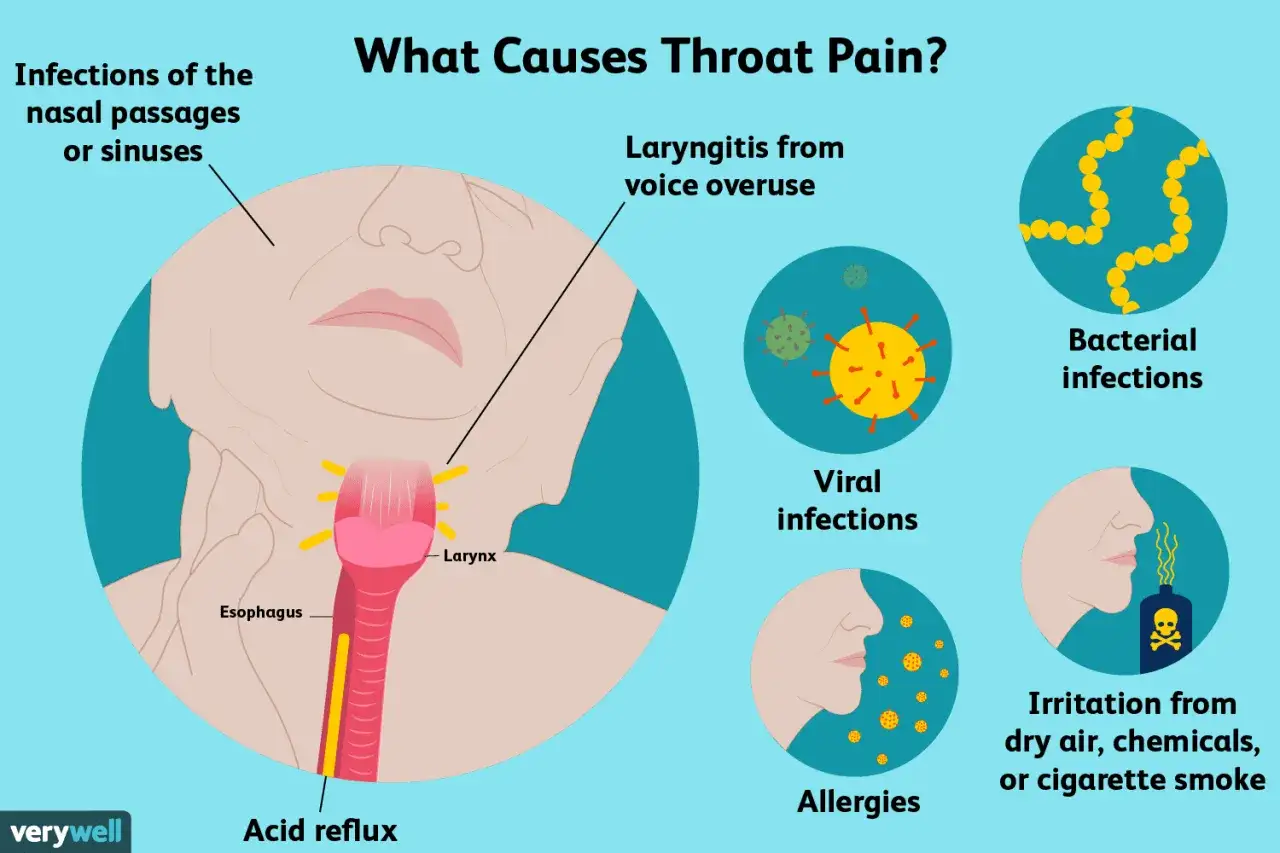 Illustration visar orsaker till ont i halsen på morgonen: infektioner, överanvändning av rösten, allergi, syraåterflöde, bakterier, virus och irritation.