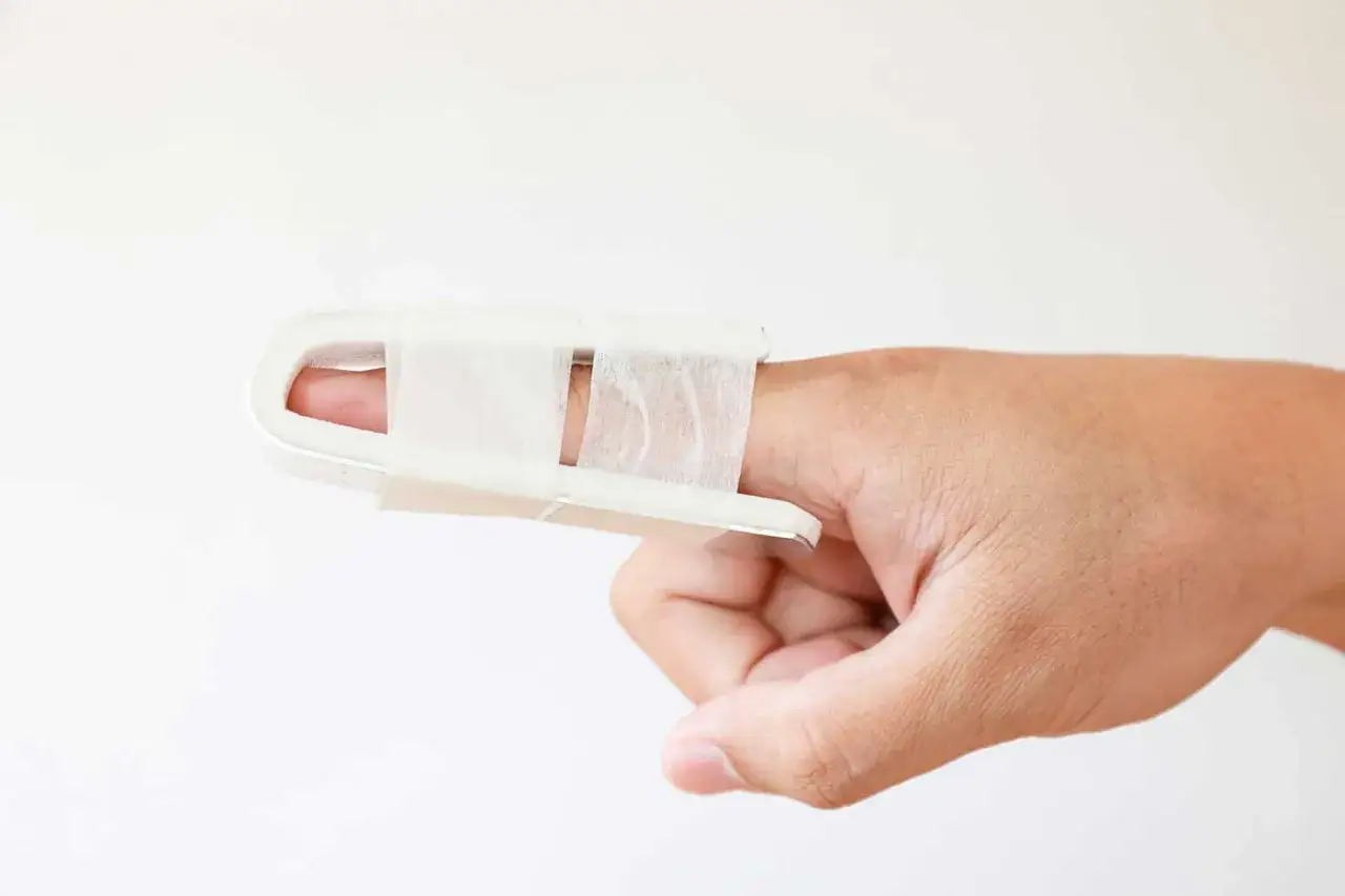 Stukat finger tejpat med en vit skena f&ouml;r att stabilisera.