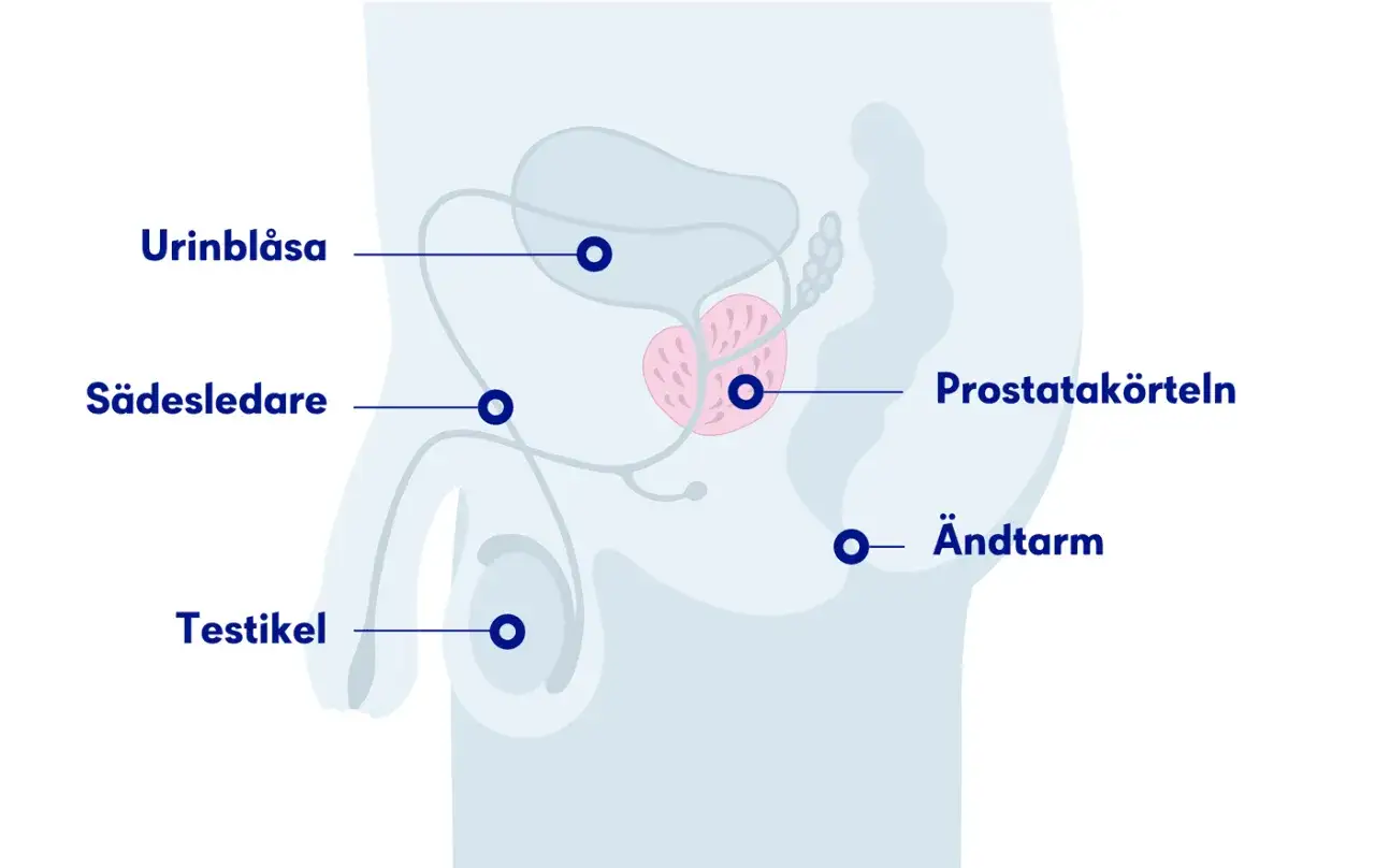 Illustration av manliga reproduktionsorganen, inklusive urinblåsa, sädesledare, testikel, prostata och ändtarm. Förstorad prostata kan orsaka svårt att kissa man.
