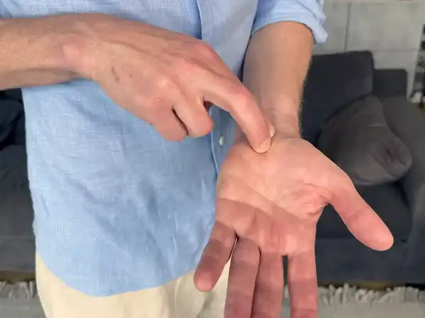 En man pekar på sin handled, kanske för att visa var han känner ont i nacken och domningar i fingrarna.