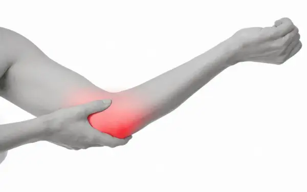 En arm med en rödmarkerad armbåge, som indikerar smärta vid artros armbåge.